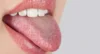 رنگ زبان شما چه هشداری درباره سلامت بدنتان می‌دهد؟